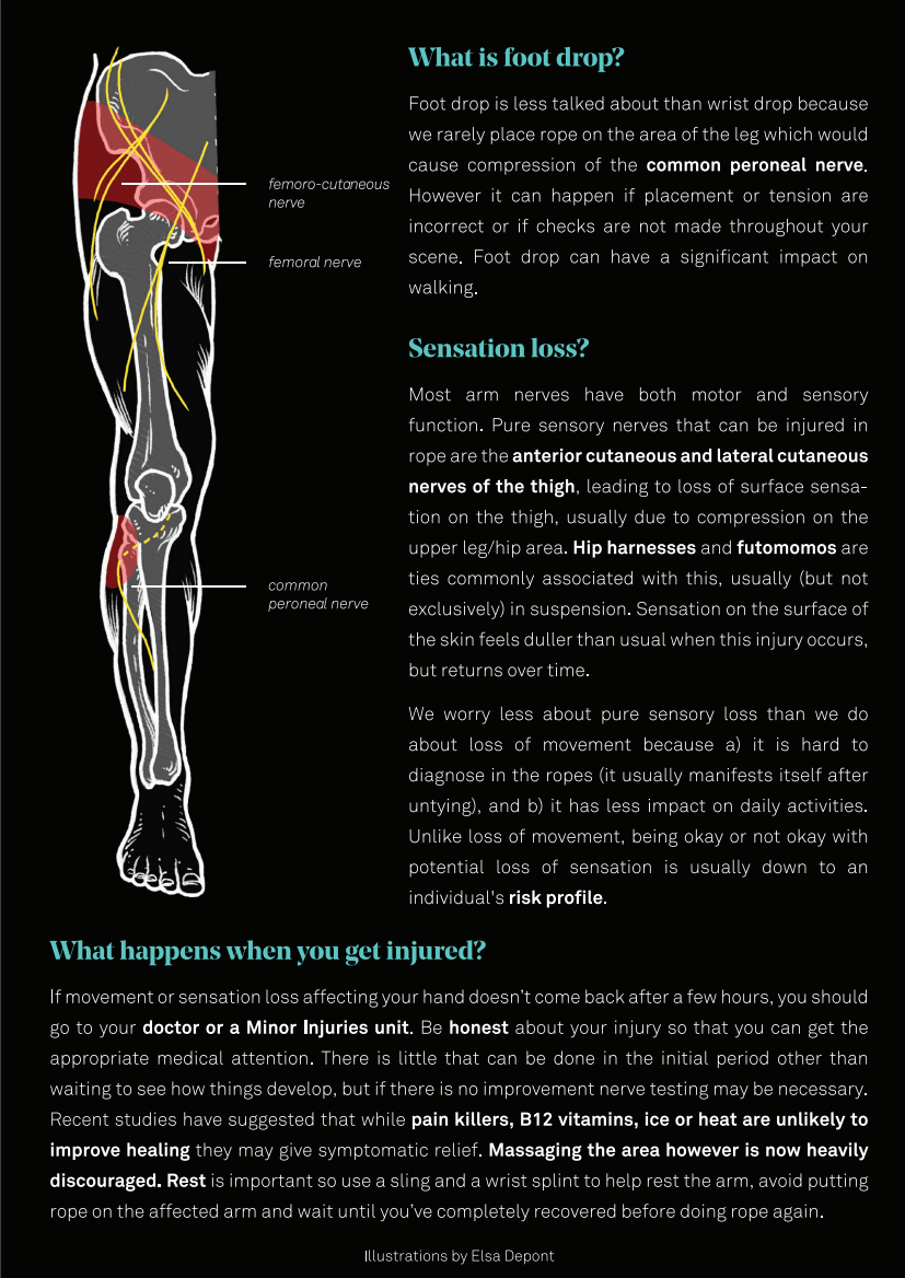 Leg nerve diagram explaining foot drop and sensation loss from hip and thigh ties