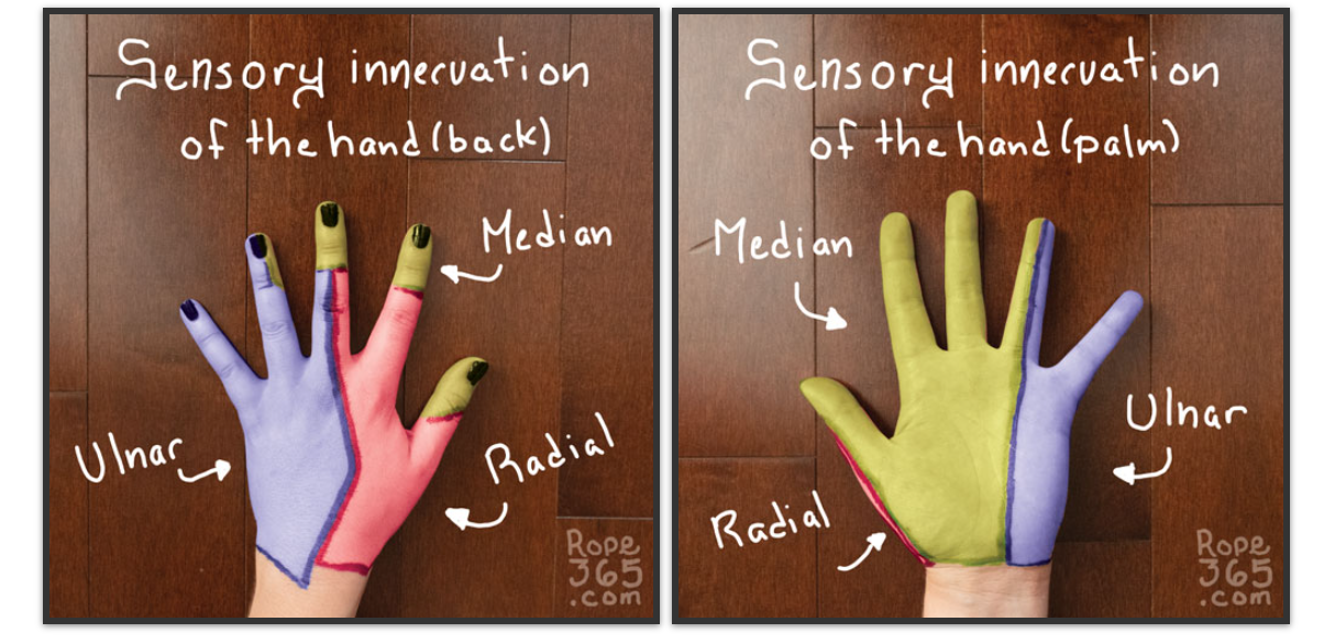 Sensory innervation of the hand, back and palm, showing the areas served by the median, ulnar, and radial nerves